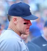 Aaron Judge bloodied after getting hit by Anthony Volpe throw between innings in wild Yankees moment
